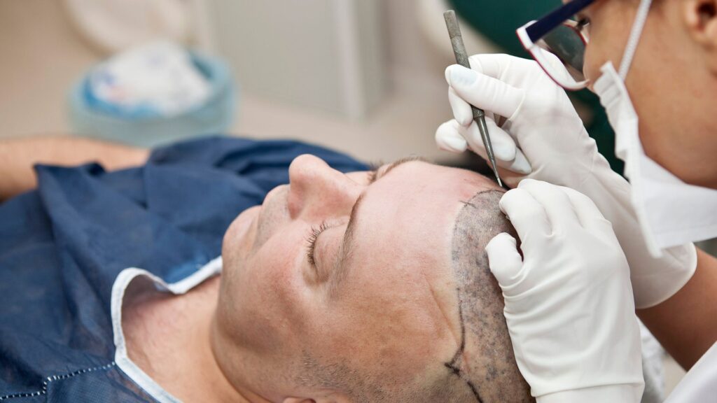Is Hair Transplant Safe