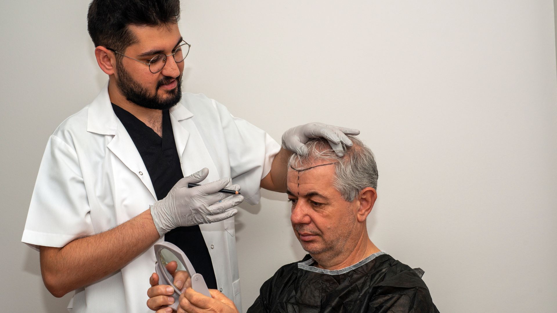 how much does a small hair transplant cost