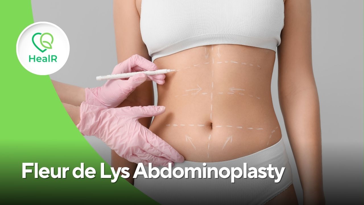 Fleur de Lys Abdominoplasty in Mumbai