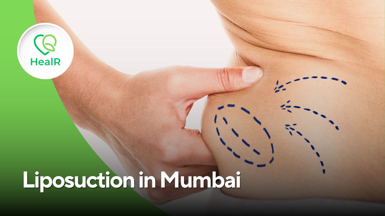 Liposuction in Mumbai