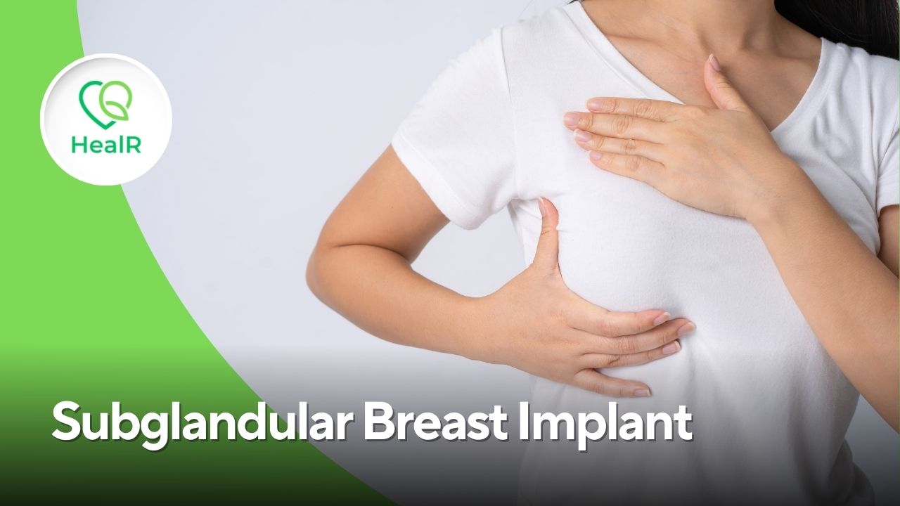 Subglandular Breast Implant in Mumbai